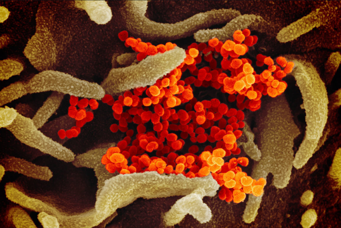 Novel Coronavirus SARS-CoV-2